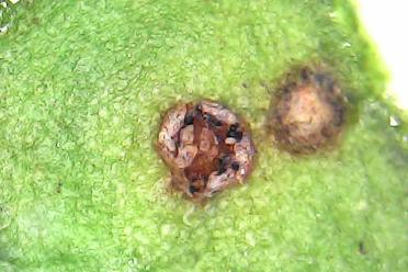 Uromyces beticola on sugar beet leaf (1000x magnification)