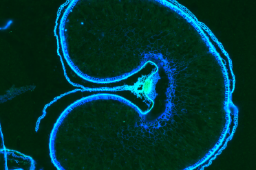 Whole wheat grain cross section fluorescence taken using the Vizgen MERSCOPE