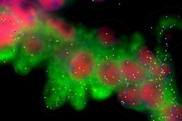 Spatial image of lung tissue