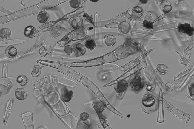 Microscopy of isolated trichomes