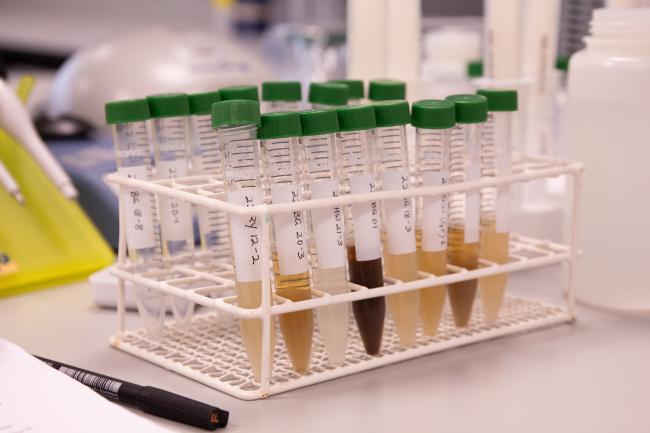 A rack of test tubes with varying shades of brown liquid.